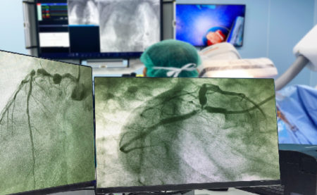 Cardiac Catheterization Laboratory Nurse Career Overview