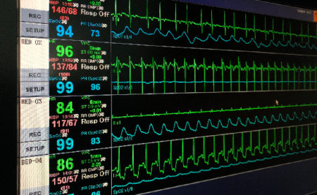 Telemetry Nurse Career Overview