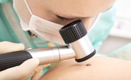 How to Become a Dermatology Nurse