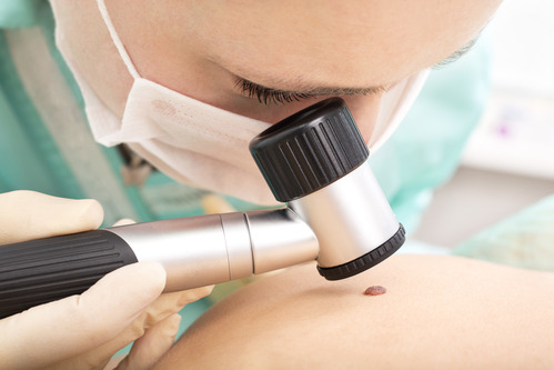 How to Become a Dermatology Nurse
