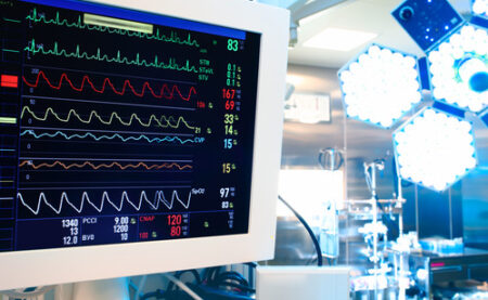 How to Become a Cardiovascular Operating Room Nurse