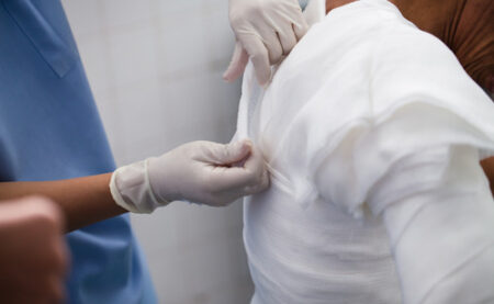 How to Become a Burn Care Nurse