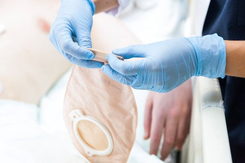 How Much Do Enterostomy Nurses Make